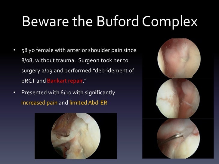 slap tear