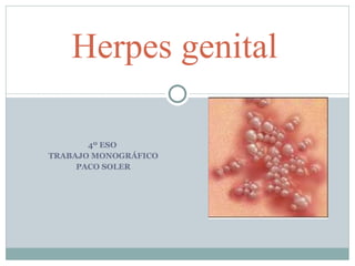 4º ESO  TRABAJO MONOGRÁFICO PACO SOLER Herpes genital 