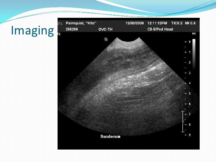 Pacreatitis grand rounds