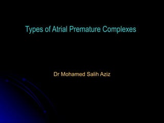 Types of Atrial Premature Complexes




        Dr Mohamed Salih Aziz
 