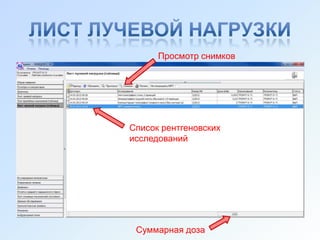 Просмотр снимков




Список рентгеновских
исследований




 Суммарная доза
 