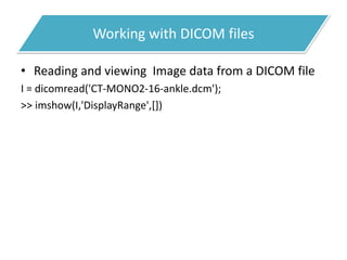 Working with DICOM files
• Reading and viewing Image data from a DICOM file
I = dicomread('CT-MONO2-16-ankle.dcm');
>> imshow(I,'DisplayRange',[])
 