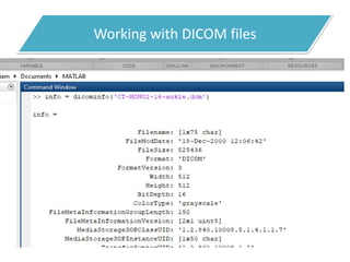 Working with DICOM files
• Reading Metadata from A DICOM file
 