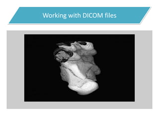 Working with DICOM files
 
