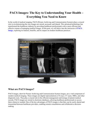 PACS Images: The Key to Understanding Your Health –
Everything You Need to Know
In the world of medical imaging, PACS (Picture Archiving and Communication System) plays a crucial
role in revolutionizing the way images are stored, accessed, and shared. This advanced technology has
transformed the healthcare industry by providing healthcare professionals with a more efficient and
effective means of managing medical images. In this post, we will delve into the intricacies of PACS
image, exploring its features, benefits, and its impact on modern healthcare practices.
What are PACS Images?
PACS images, short for Picture Archiving and Communication System images, are a vital component of
modern medical imaging. These images are digital representations of X-rays, CT scans, MRIs, and other
diagnostic tests. They play a crucial role in the efficient management and storage of patient medical
records. PACS images are stored in electronic databases, allowing healthcare professionals to access
them whenever needed. One of the key advantages of PACS images is that they can be easily shared and
transmitted between healthcare providers, enabling remote consultations and collaborative decision-
making.
 