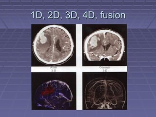 1D, 2D, 3D, 4D, fusion1D, 2D, 3D, 4D, fusion
 