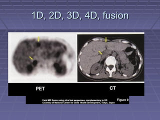 1D, 2D, 3D, 4D, fusion1D, 2D, 3D, 4D, fusion
 