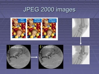 JPEG 2000 imagesJPEG 2000 images
 