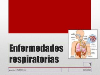 Enfermedades
respiratorias
04/06/2015practica 2 PATRONES
1
 