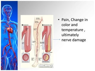 • Pain, Change in
  color and
  temperature ,
  ultimately
  nerve damage
 