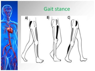 Gait stance
 