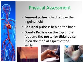 Physical Assessment
• Femoral pulses: check above the
  inguinal fold
• Popliteal pulse is behind the knee
• Doralis Pedis is on the top of the
  foot and the posterior tibial pulse
  in on the medial aspect of the
  ankle
 