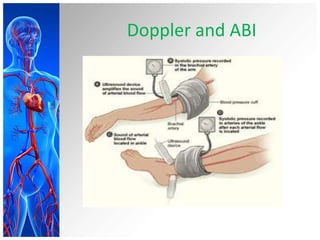 Doppler and ABI
 