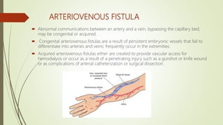 Peripheral artery disease | PPTX