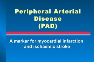 Peripheral Arterial Disease (PAD) A marker for myocardial infarction  and ischaemic stroke 