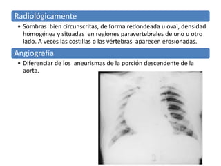 Radiológicamente 
• Sombras bien circunscritas, de forma redondeada u oval, densidad 
homogénea y situadas en regiones paravertebrales de uno u otro 
lado. A veces las costillas o las vértebras aparecen erosionadas. 
Angiografía 
• Diferenciar de los aneurismas de la porción descendente de la 
aorta. 
 