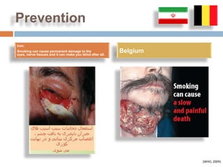 Prevention
Iran:
Smoking can cause permanent damage to the
eyes, nerve tissues and it can make you blind after all.
                                                           Belgium




                                                                     (WHO, 2009)
 