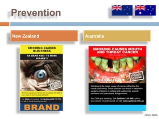 Prevention

New Zealand   Australia




                          (WHO, 2009)
 
