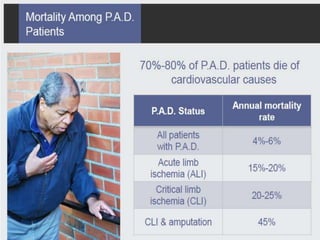 PAD & Lower Extremity Interventions | PPTX