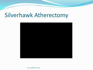 SilverhawkAtherectomywww.radclinic.com