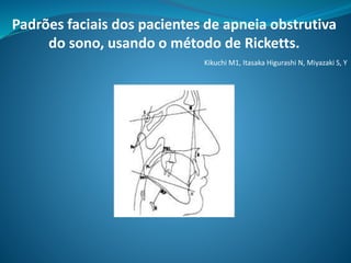 Padrões faciais dos pacientes de apneia obstrutiva
do sono, usando o método de Ricketts.
Kikuchi M1, Itasaka Higurashi N, Miyazaki S, Y
 