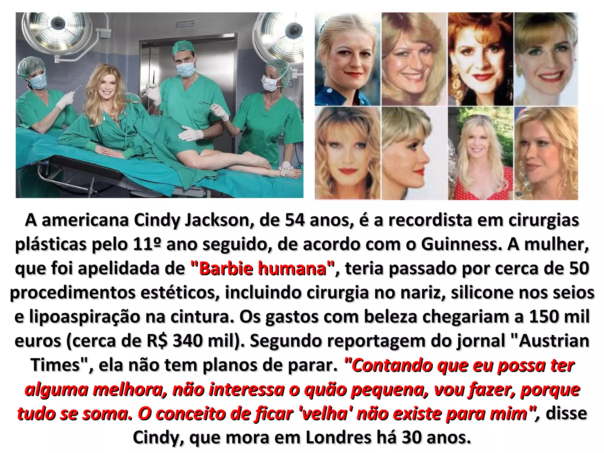 A americana Cindy Jackson, de 54 anos, é a recordista em cirurgias
plásticas pelo 11º ano seguido, de acordo com o Guinness. A mulher,
que foi apelidada de "Barbie humana", teria passado por cerca de 50
procedimentos estéticos, incluindo cirurgia no nariz, silicone nos seios
e lipoaspiração na cintura. Os gastos com beleza chegariam a 150 mil
euros (cerca de R$ 340 mil). Segundo reportagem do jornal "Austrian
   Times", ela não tem planos de parar. "Contando que eu possa ter
  alguma melhora, não interessa o quão pequena, vou fazer, porque
 tudo se soma. O conceito de ficar 'velha' não existe para mim", disse
               Cindy, que mora em Londres há 30 anos.
 