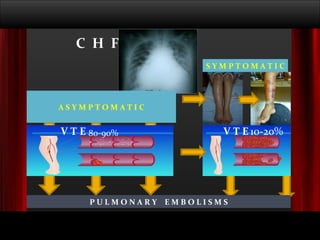 P U L M O N A R Y  E M B O L I S M S A S Y M P T O M A T I C 80-90% 10-20% V T E C  H  F V T E S Y M P T O M A T I C 