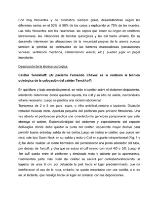 Son muy frecuentes y de pronóstico siempre grave, desarrollándose según las
diferentes series en el 50% al 90% de los casos y explicando un 75% de las muertes.
Las más frecuentes son las neumonías, las sepsis que tienen su origen en catéteres
intravenosos, las infecciones de heridas quirúrgicas y las del tracto urinario. En su
desarrollo intervienen las alteraciones de la inmunidad propias de la uremia aunque
también la pérdida de continuidad de las barreras mucocutáneas (canulaciones
venosas, ventilación mecánica, cateterización vesical, etc.) pueden jugar un papel
importante.
Descripción de la técnica quirúrgica:
Catéter Tenckhoff: (Al paciente Fernando Chávez se le realizara la técnica
quirúrgica de la colocación del catéter Tenckhoff)
En quirófano y bajo anestesiageneral, se mide el catéter sobre el abdomen delpaciente,
intentando determinar donde quedará lapunta, los cuff y su sitio de salida, marcándolos
sifuera necesario. Luego se practica una incisión abdominal,
Transversa de 2 o 3 cm. para, supra, o infra umbilical,derecha o izquierda. Divulsión
romadel músculo recto. Apertura pequeña del peritoneo para prevenir filtraciones. Una
vez abierto el peritoneose practica una omentectomía generosa paraprevenir que este
obstruya el catéter. Exploracióndigital del abdomen y especialmente del espacio
deDouglas donde debe quedar la punta del catéter, espaciode mayor declive para
permitir buena entraday salida de los baños.Luego se instala el catéter, que puede ser
recto ode tipo Swan Neck en su salida y recto o Coil en supunta intraperitoneal (Fig. 1 y
2).Se debe realizar un cierre hermético del peritoneocon una jareta alrededor del tubo,
por debajo de 1ercuff, y otra que se sutura al cuff mismo con vicryl 4/0 o 3/0. Luego el
1er cuff queda entre el peritoneo y elmúsculo recto y cubierto por la aponeurosis.
Finalmentela parte más distal del catéter se sacará por contraberturahaciendo un
trayecto de unos 6 cm. por debajode la piel, hacia el lugar predeterminado, que no
interfieracon el uso de la ropa, cinturón, no quede encontacto con una costilla, o si es
en un lactante, que nosalga hacia un lugar en contacto con las deposiciones.
 