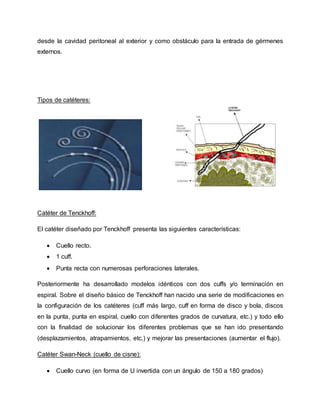 desde la cavidad peritoneal al exterior y como obstáculo para la entrada de gérmenes
externos.
Tipos de catéteres:
Catéter de Tenckhoff:
El catéter diseñado por Tenckhoff presenta las siguientes características:
 Cuello recto.
 1 cuff.
 Punta recta con numerosas perforaciones laterales.
Posteriormente ha desarrollado modelos idénticos con dos cuffs y/o terminación en
espiral. Sobre el diseño básico de Tenckhoff han nacido una serie de modificaciones en
la configuración de los catéteres (cuff más largo, cuff en forma de disco y bola, discos
en la punta, punta en espiral, cuello con diferentes grados de curvatura, etc.) y todo ello
con la finalidad de solucionar los diferentes problemas que se han ido presentando
(desplazamientos, atrapamientos, etc.) y mejorar las presentaciones (aumentar el flujo).
Catéter Swan-Neck (cuello de cisne):
 Cuello curvo (en forma de U invertida con un ángulo de 150 a 180 grados)
 