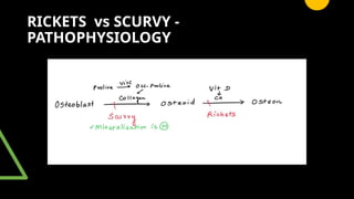 paed high yield git, scurvy , rickets radiology | PPTX