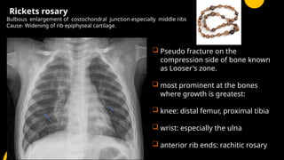 paed high yield git, scurvy , rickets radiology | PPTX