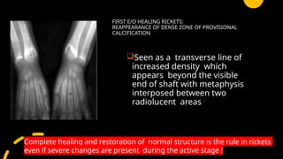 paed high yield git, scurvy , rickets radiology | PPTX