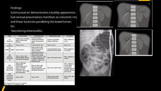 paed high yield git, scurvy , rickets radiology | PPTX