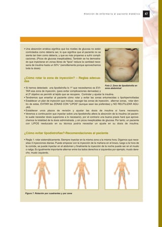 47A t e n c i ó n d e e n f e r m e r í a a l p a c i e n t e d i a b é t i c o
• Una absorción errática significa que los niveles de glucosa no están
controlados como debería ser, lo que significa que el paciente no se
siente tan bien como debería, y que es más propenso a sufrir compli-
caciones. (Picos de glucosa inexplicables). También se ha demostra-
do que inyectarse en zonas libres de “lipos” reduce la cantidad nece-
saria de insulina hasta un 50%* (sencillamente porque aprovechamos
toda la dosis)
¿Cómo rotar la zona de inyección? – Reglas adecua-
das
• Si hemos detectado una lipodistrofia lo 1º que necesitamos es EVI-
TAR esa zona de inyección, (para evitar complicaciones derivadas) y
el 2º objetivo es permitir al tejido que se recupere. Controlar y ajustar la insulina.
• Tendremos que enseñar al paciente cómo rotar y evitar las zonas entumecidas o lipohipertrofiadas
• Establecer un plan de inyección que incluya escoger las zonas de inyección, alternar zonas, rotar den-
tro de estas, EVITAR las ZONAS CON “LIPOS” (aunque sean las preferidas) y NO REUTILIZAR AGU-
JAS.
• Establecer unos plazos de revisión y ajustar las dosis de insulina si fuera necesario.
• Veremos a continuación que inyectar sobre una lipodistrofia altera la absorción de la insulina (el pacien-
te suele necesitar dosis superiores a lo necesario), por el contrario una buena praxis hará que aprove-
chemos la totalidad de la dosis administrada, y sin picos inexplicables de glucosa. Por tanto, un paciente
con LIPOS reeducado en su técnica podría necesitar un ajuste en su dosis de insulina.
¿Cómo evitar lipodistrofias?-Recomendaciones al paciente
• Regla 1: rotar sistemáticamente. Siempre inyectar en la misma zona a la misma hora. Digamos que nece-
sitas 3 inyecciones diarias. Puede empezar con la inyección de la mañana en el brazo, luego a la hora de
la comida, se puede inyectar en el abdomen y finalmente la inyección de la noche puede ser en el muslo
o nalga. Es igualmente importante alternar entre los lados derechos e izquierdos por ejemplo, muslo dere-
cho, muslo izquierdo.
Foto 2. Zona de lipodistrofia en
zona abdominal
Figura 7. Rotación por cuadrantes y por zona
Protocolo diabetes 2010 cam color def 4/11/10 11:21 Página 47
 