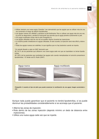 49A t e n c i ó n d e e n f e r m e r í a a l p a c i e n t e d i a b é t i c o
Aunque nada pueda garantizar que el paciente no tendrá lipodistrofias, sí se puede
disminuir las probabilidades considerablemente si se aconseja que el paciente:
• Alterne las zonas de inyección.
• Rote dentro de las zonas inyección (dejando mínimo un dedo de distancia entre
inyecciones).
• Utilice una nueva aguja cada vez que se inyecte.
• Utilizar siempre una nueva aguja. Estudios* han demostrado que las agujas que se utilizan más de una
vez aumentan el riesgo de adquirir lipodistrofias.
• Las agujas nuevas son afiladas y penetran la piel fácilmente. Pero si utilizas una aguja más de una vez,
la punta se despuntará y perderá el lubricante que permite que la aguja penetre suavemente tu piel.
• Una aguja reutilizada rompe más la piel (Fotografía 4).
• Las agujas utilizadas más de una vez se pueden obstruir durante las inyecciones.
• La insulina puede cristalizarse en agujas utilizadas. Si esto sucede, la inyección será más difícil y doloro-
sa.
• Todas las agujas nuevas son estériles, lo que significa que no hay bacterias cuando se inyecta.
*Un estudio llevado a cabo en 2007 demostró que:
•El 79,7% de los pacientes que utilizaron una nueva aguja cada vez que se inyectaban no tenían lipodis-
trofias.
•El 100% de los pacientes que cambiaban las agujas solo cuando reemplazaban el cartucho presentaron
lipodistrofias!. B. Varder and S. Kizilci (2007)
Fotografía 4: muestra el tipo de daño que puede ocasionar la reutilización de una aguja. Imagen aumentada x
370.
Protocolo diabetes 2010 cam color def 4/11/10 11:21 Página 49
 