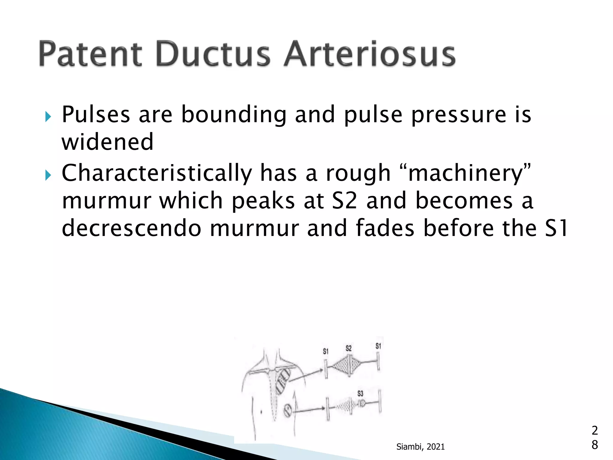  Pulses are bounding and pulse pressure is
widened
 Characteristically has a rough “machinery”
murmur which peaks at S2 and becomes a
decrescendo murmur and fades before the S1
2
8
Siambi, 2021
 