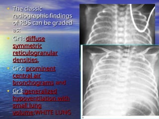 Paediatrics-Chest-radiology spotters.ppt