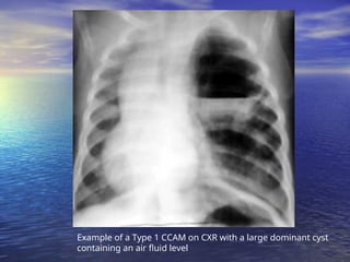 Paediatrics-Chest-radiology spotters.ppt
