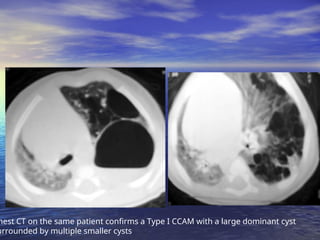Paediatrics-Chest-radiology spotters.ppt