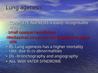 Paediatrics-Chest-radiology spotters.ppt