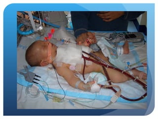 paediatric-septic-shock power point presentation