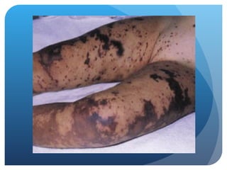 paediatric-septic-shock power point presentation