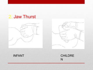 2. Jaw Thurst
INFANT CHILDRE
N
 