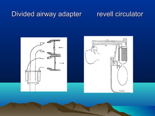 Divided airway adapter revell circulatorDivided airway adapter revell circulator
 