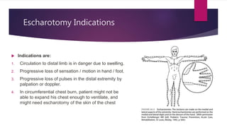 Escharotomy Indications
 Indications are:
1. Circulation to distal limb is in danger due to swelling.
2. Progressive loss of sensation / motion in hand / foot.
3. Progressive loss of pulses in the distal extremity by
palpation or doppler.
4. In circumferential chest burn, patient might not be
able to expand his chest enough to ventilate, and
might need escharotomy of the skin of the chest
 