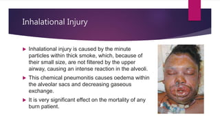 Inhalational Injury
 Inhalational injury is caused by the minute
particles within thick smoke, which, because of
their small size, are not filtered by the upper
airway, causing an intense reaction in the alveoli.
 This chemical pneumonitis causes oedema within
the alveolar sacs and decreasing gaseous
exchange.
 It is very significant effect on the mortality of any
burn patient.
 