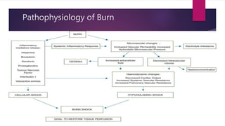 Pathophysiology of Burn
 