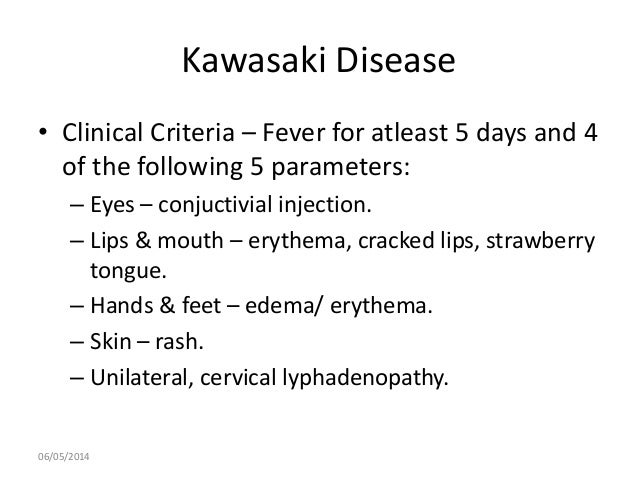 Kawasaki Disease Major And Minor Criteria Kawasaki Disease Major And Minor Criteria