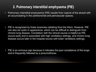 2. Pulmonary interstitial emphysema (PIE)
• Pulmonary interstitial emphysema (PIE) results from rupture of the alveoli with
air accumulating in the peribronchial and perivascular spaces.
• PIE is recognized by linear lucencies radiating from the hilum. However, PIE
can also be cystic in appearance, which can be difficult to distinguish from
chronic lung disease. Correlation with the clinical course is helpful as PIE
occurs early and is associated with high ventilatory settings, and chronic lung
disease occurs later in the hospital course with lower ventilatory settings.
• PIE is an ominous sign because it indicates the poor compliance of the lungs
and is frequently followed by a pneumothorax.
 