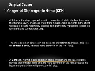 Surgical Causes
1. Congenital Diaphragmatic Hernia (CDH)
• A defect in the diaphragm will result in herniation of abdominal contents into
the thoracic cavity. The mass effect from the abdominal contents in the chest
will lead to severe respiratory distress from pulmonary hypoplasia in both the
ipsilateral and contralateral lung.
• The most common defect is in the posterior and lateral diaphragm. This is a
Bochdalek hernia, which is more common on the left (75%).
• A Morgagni hernia is less common and is anterior and medial. Morgagni
hernias present later in life and are more common on the right because the
heart and pericardium will protect the left side.
 